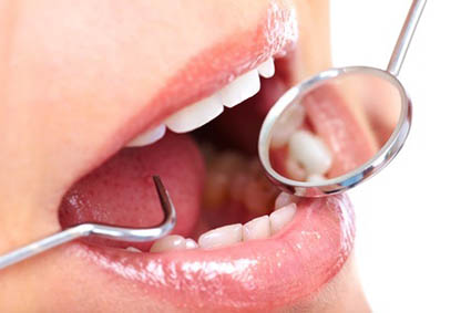 Los factores que afectan la salud de tus dientes